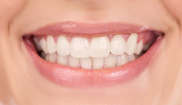 teeth whitening cost Singapore