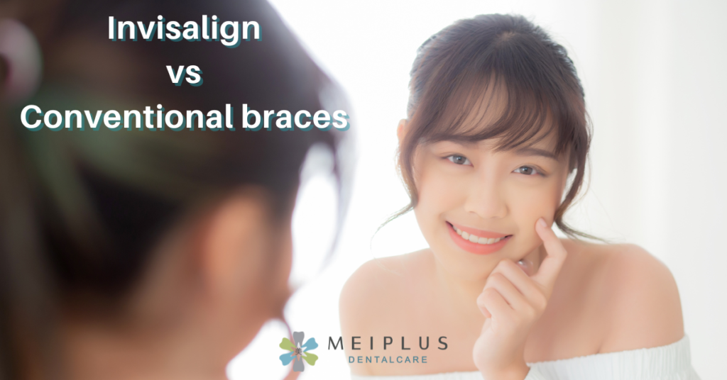 2024 Invisalign vs Conventional Braces: Which Is Right for You?
