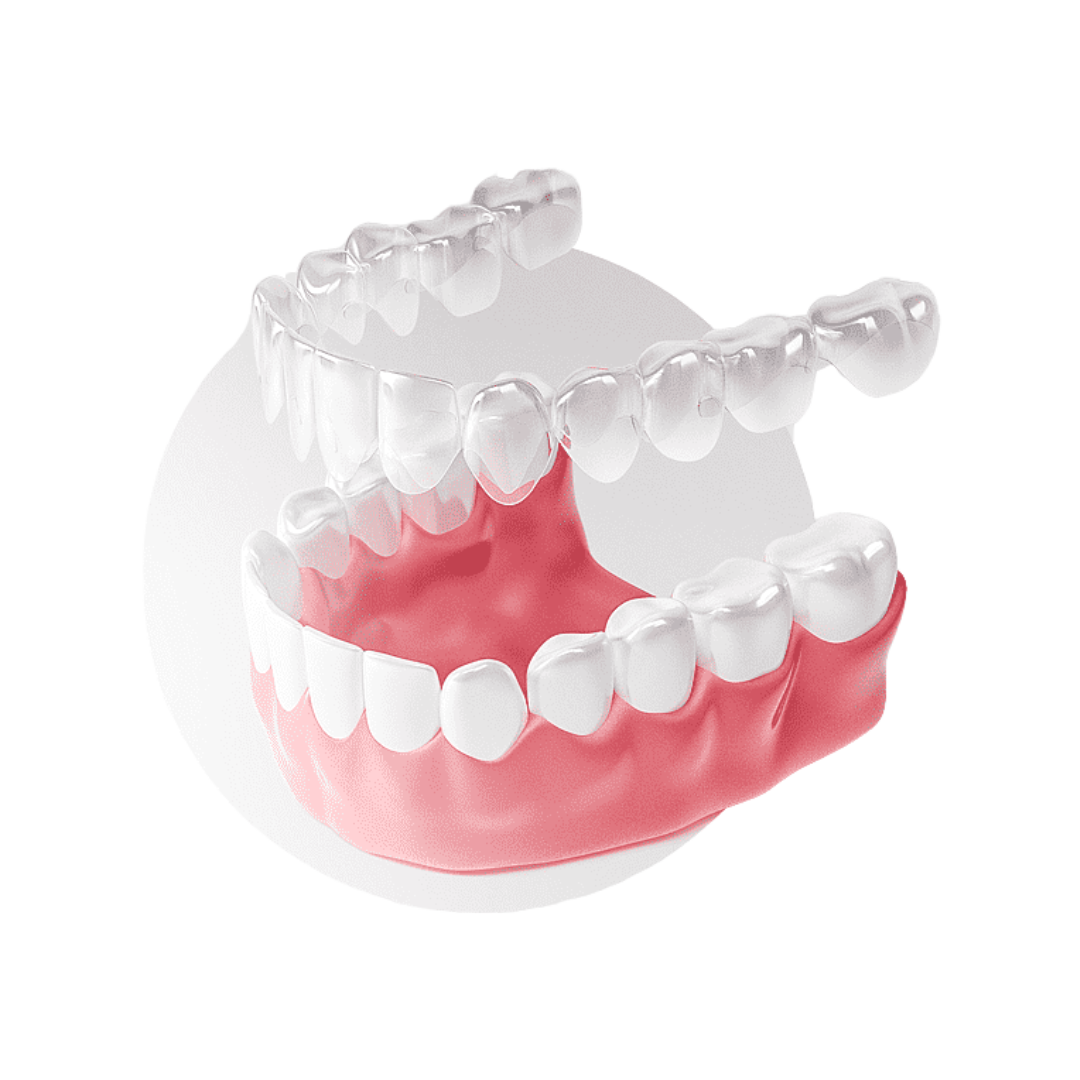 invisalign sunday