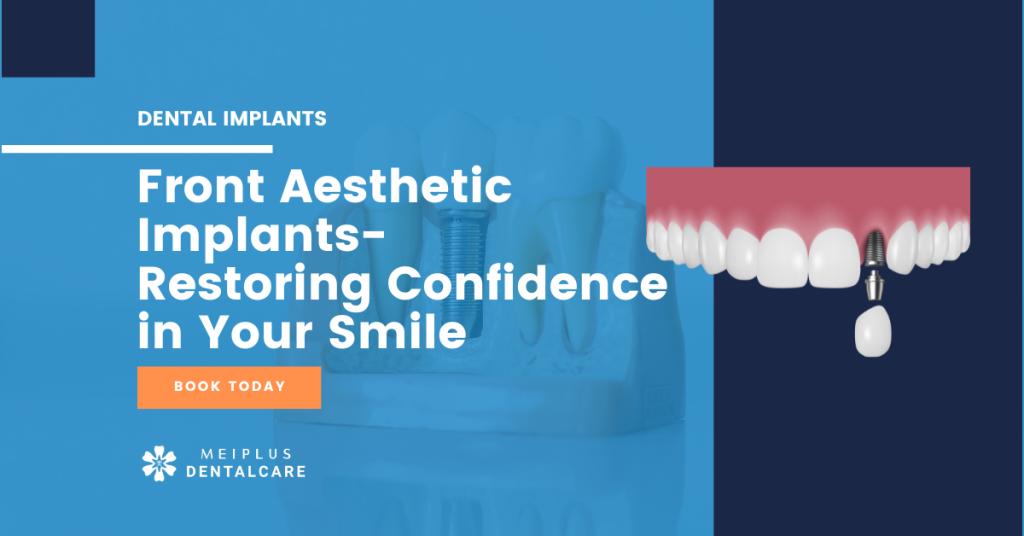 Front tooth aesthetic dental implant