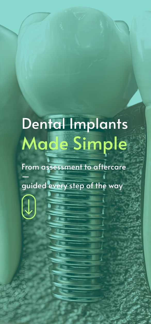 dental implant singapore