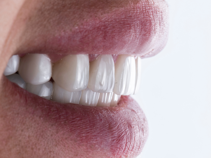 smile makeover Sunday smile makeover Sunday