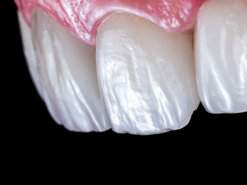 smile makeover Sunday