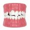 Crooked or Crowded Teeth