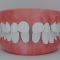 Gaps Between Teeth